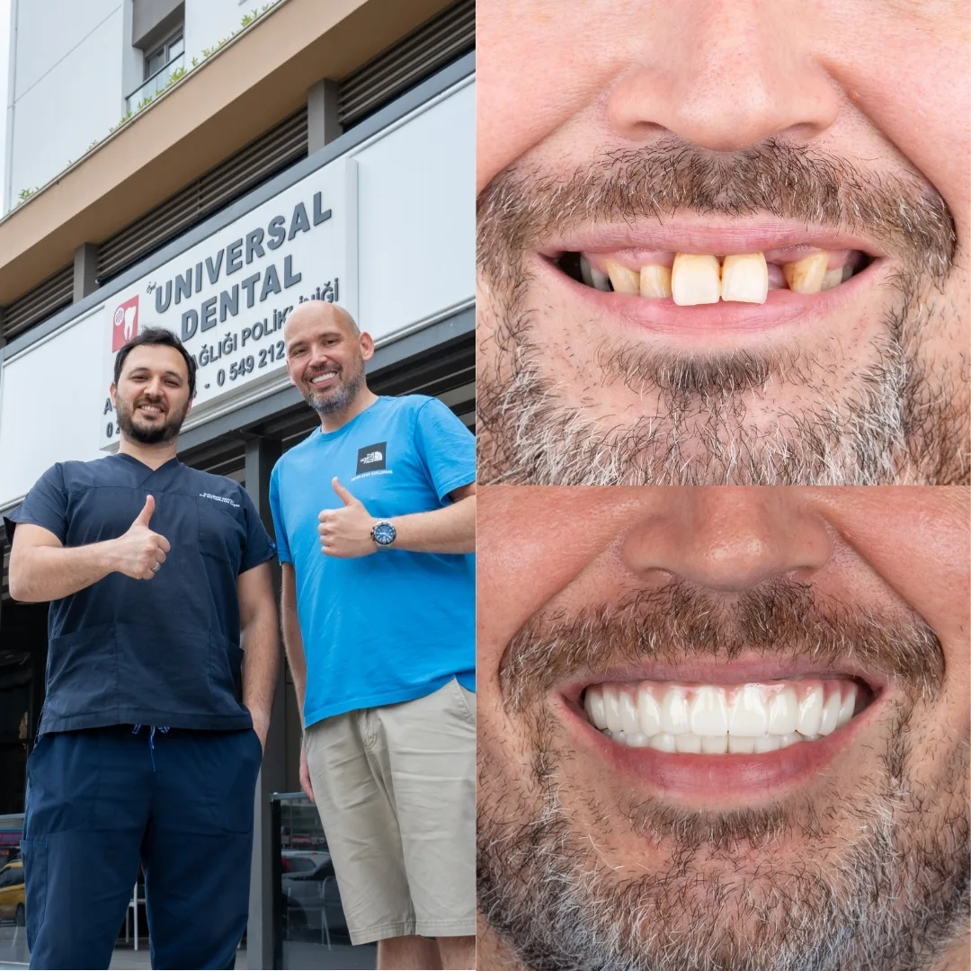 Before and after dental treatment result 10
