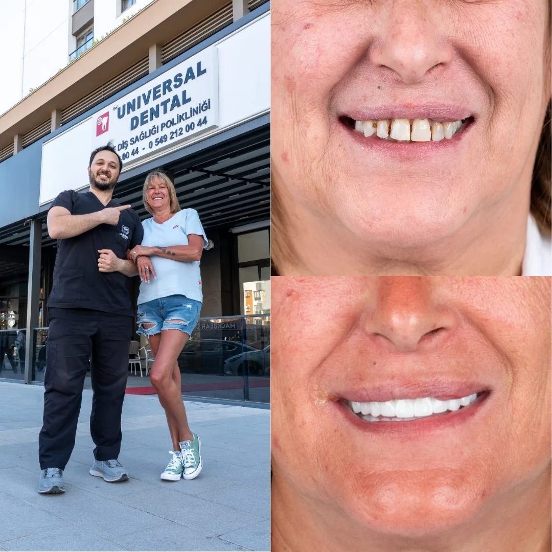Before and after dental treatment result 11