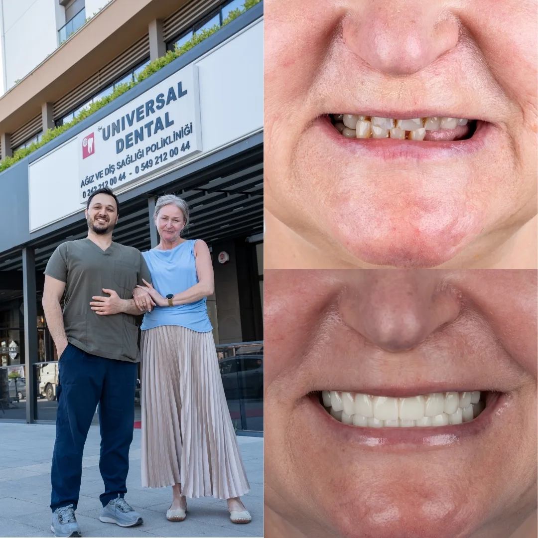 Before and after dental treatment result 5