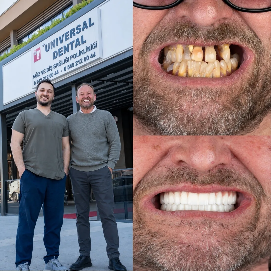 Before and after dental treatment result 6
