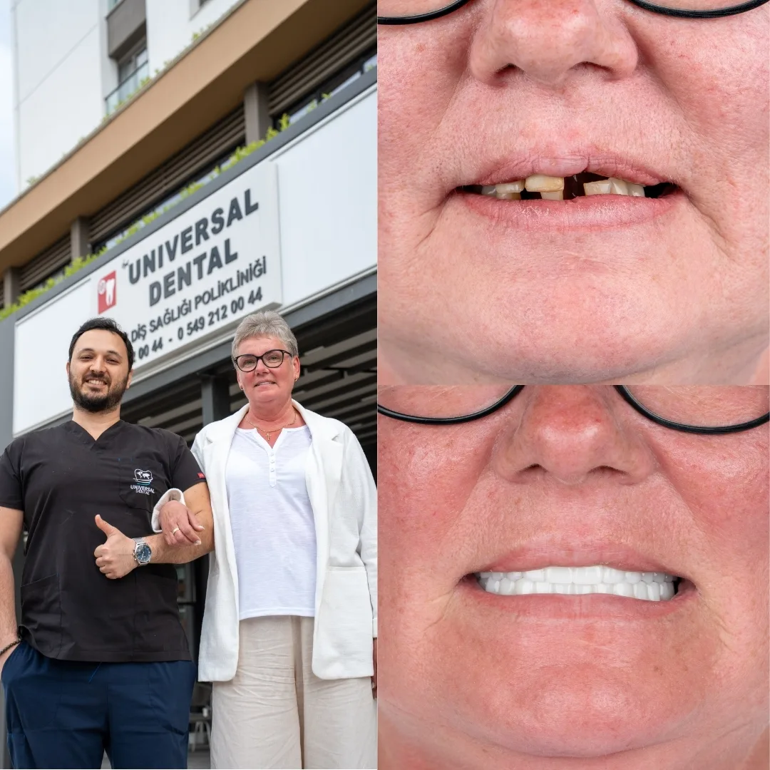 Before and after dental treatment result 7