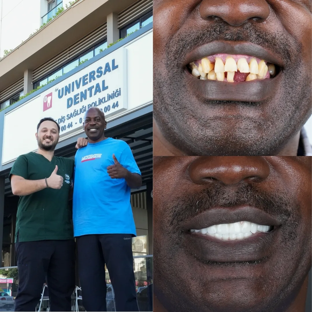 Before and after dental treatment result 8