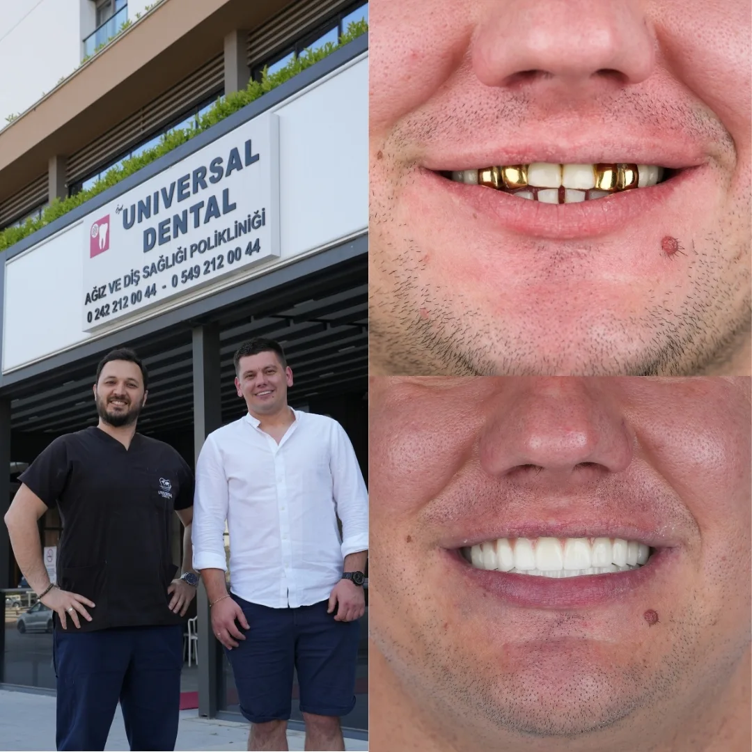 Before and after dental treatment result 9